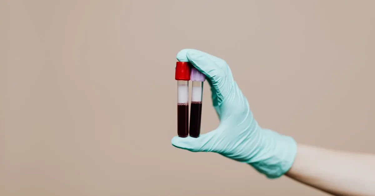 Hipotireoidismo e emagrecimento: a tireoide atrapalha mesmo?